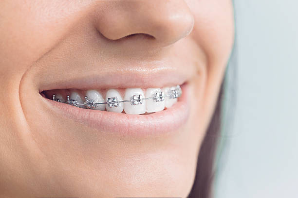 Best Invisalign and Clear Aligners  in Magnolia, TX